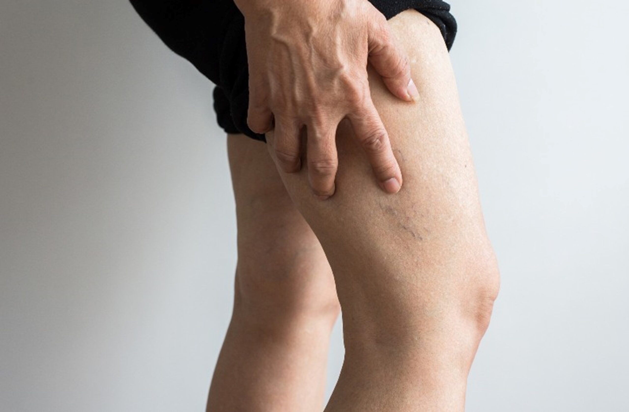 Peripheral vascular disease on leg by Arizona Vein & Laser Institute