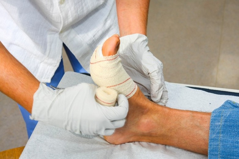 Person wrapping a foot in medical wrap by Arizona Vein & Laser Institute